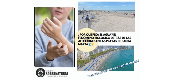 por que pica el agua el fenomeno biologico detras de las afecciones en las playas de santa marta